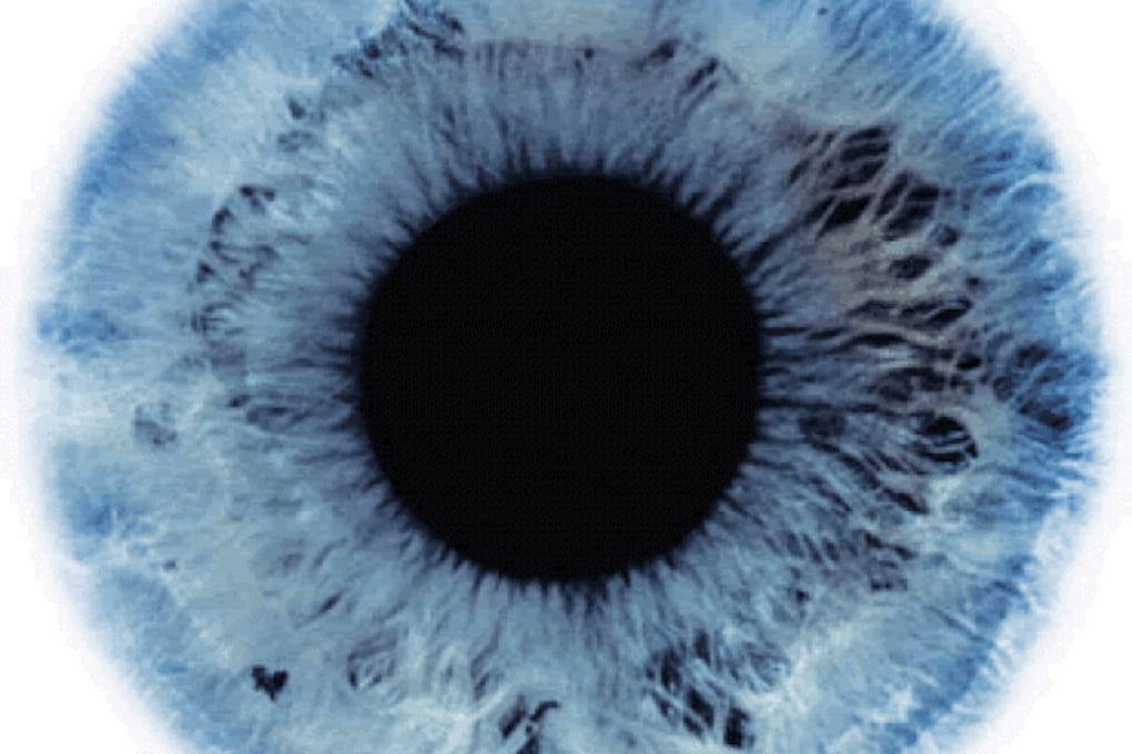 eye