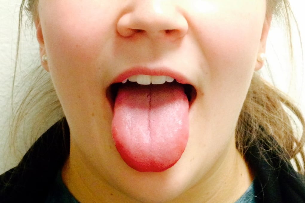 photo 1 4
