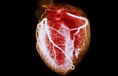 PRinc rm arteriogram of healthy heart